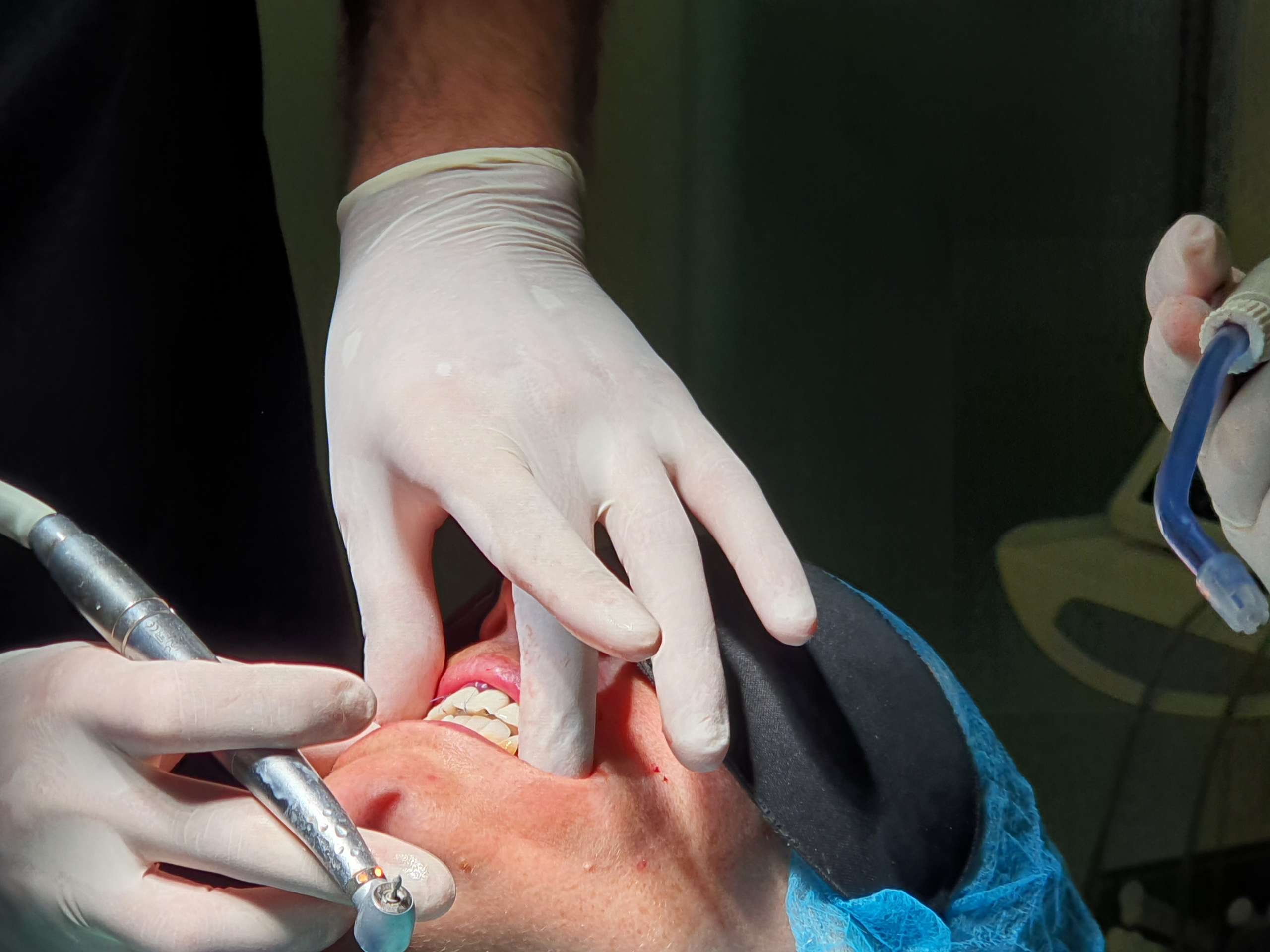 Implants dentaires au Portugal